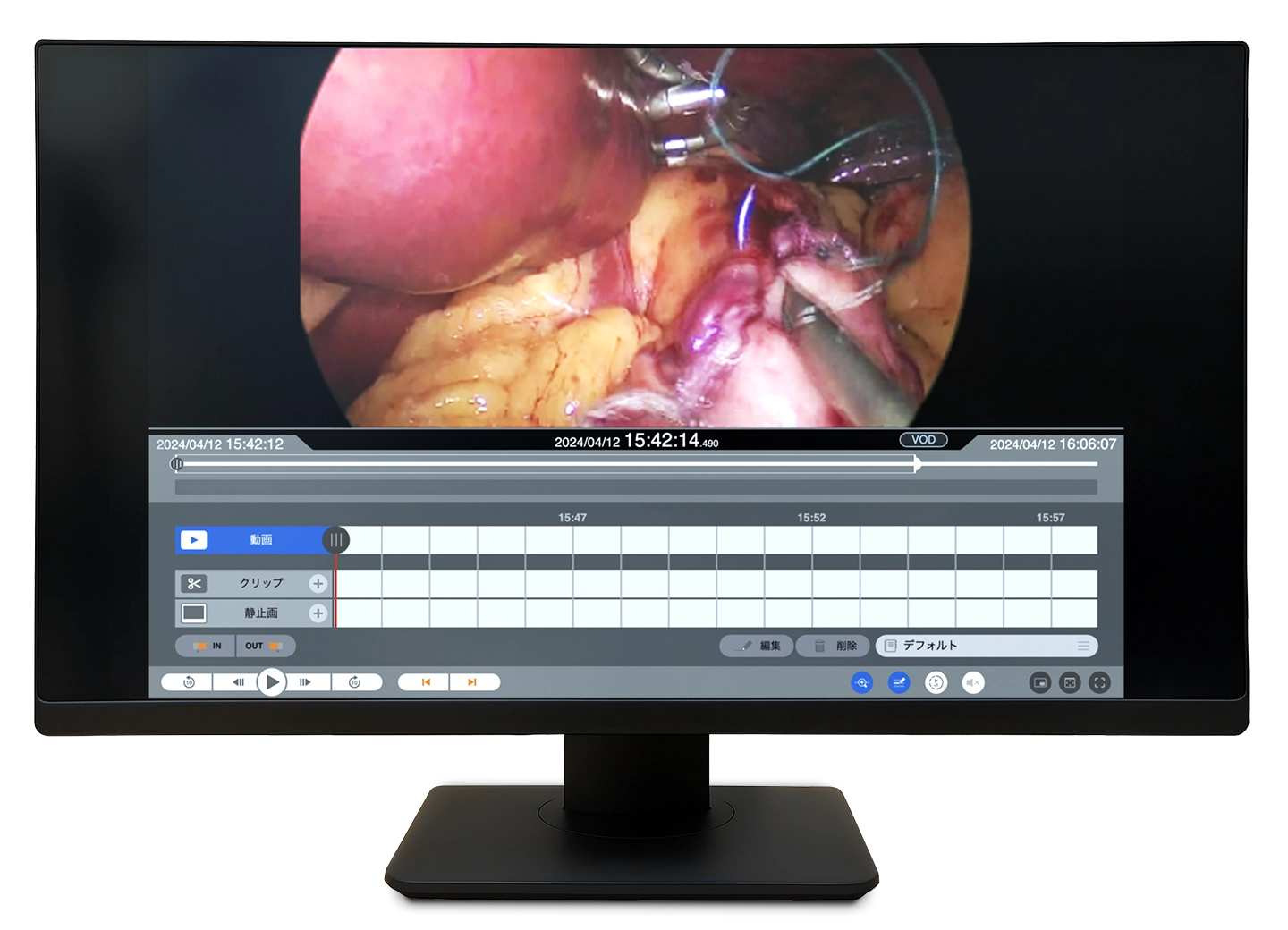 HIS端末／参照用端末